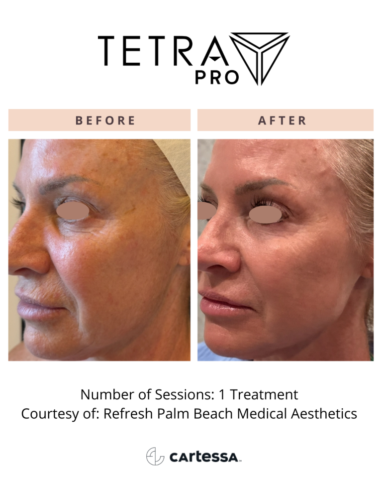 TetraPRO119175553141559