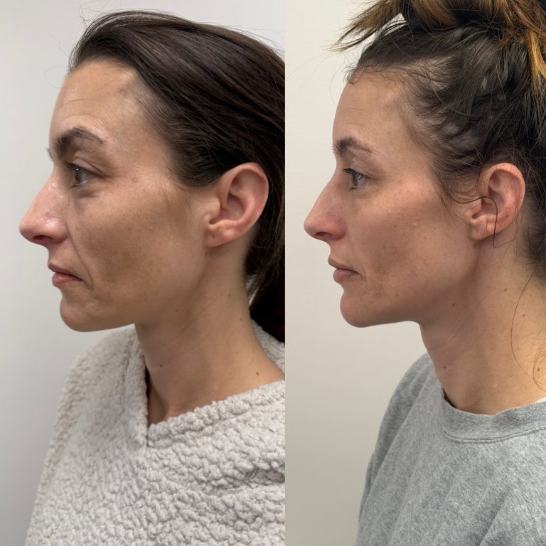 1735D524-1DDC-4FB7-9E42-F3B2FA237822