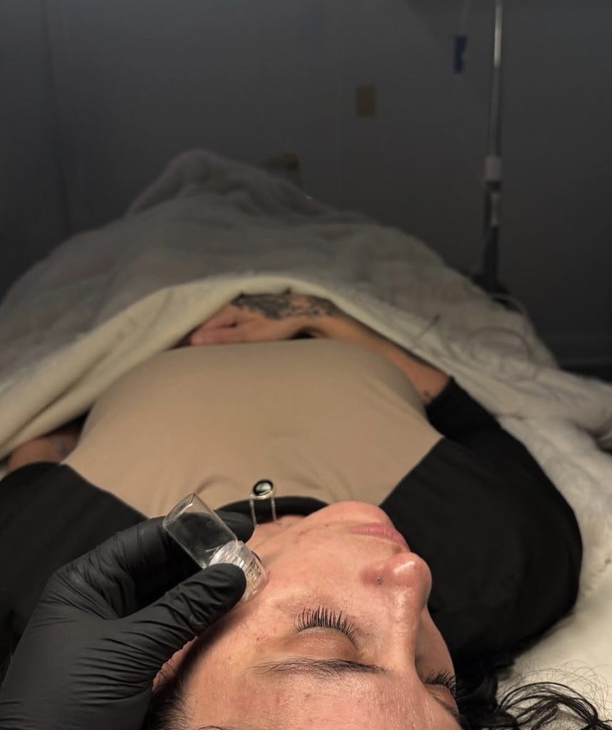 Botox Microchanneling: The Ultimate Skin-Smoothing Treatment, Revived med spa camp hill pa 